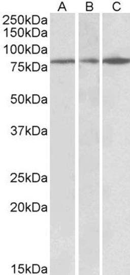 Western blot analysis of staining of Human Cerebral Cortex (A), Human Frontal Cortex (B) and Mouse Brain lysates using PAPD5 antibody.