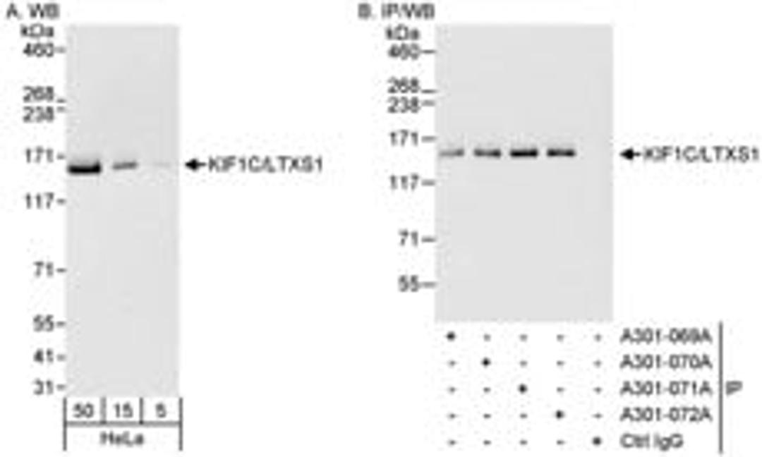 Detection of human KIF1C/LTXS1 by western blot and immunoprecipitation.