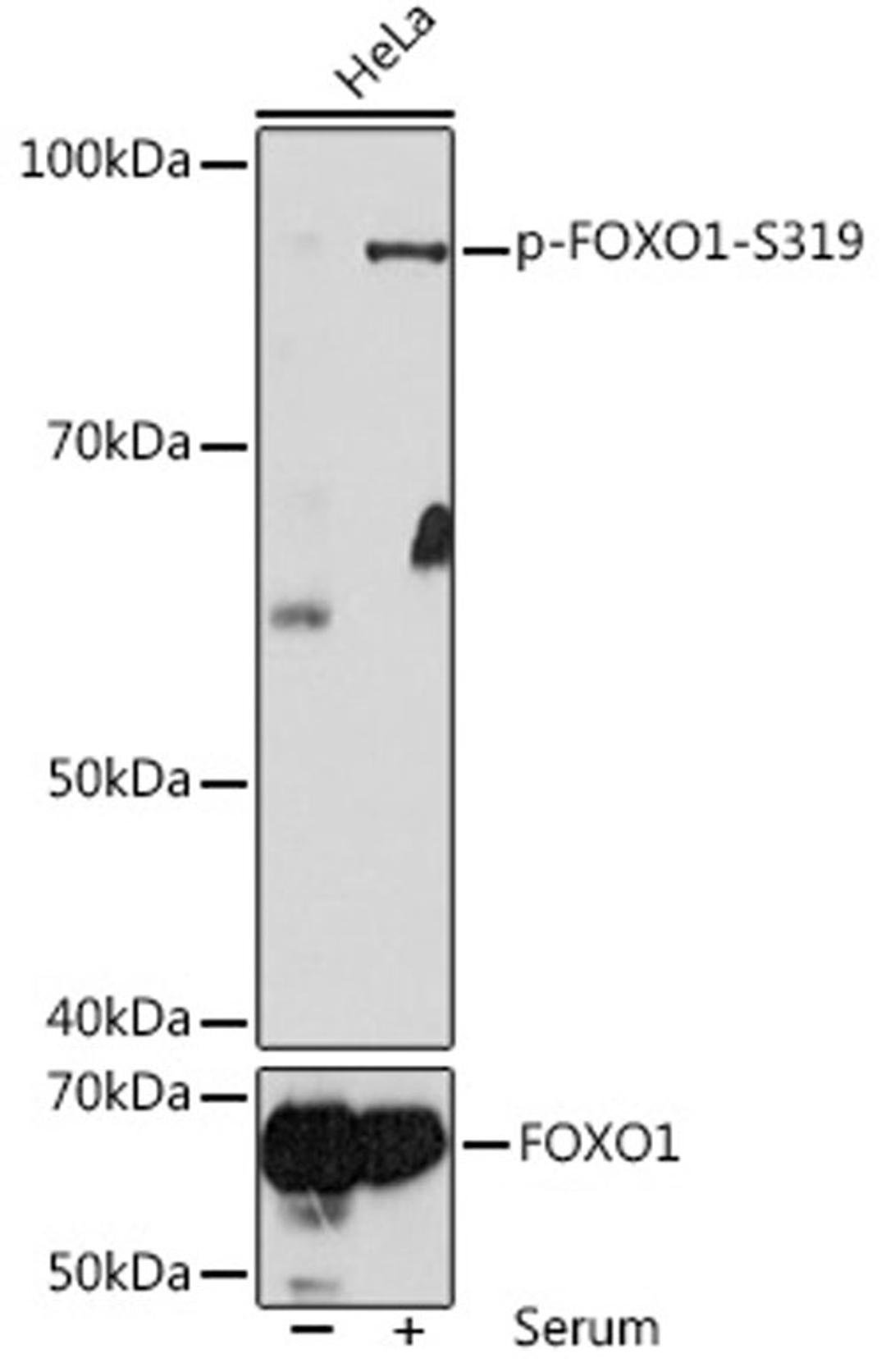 Western blot - Phospho-FOXO1-S319 antibody (AP1090)