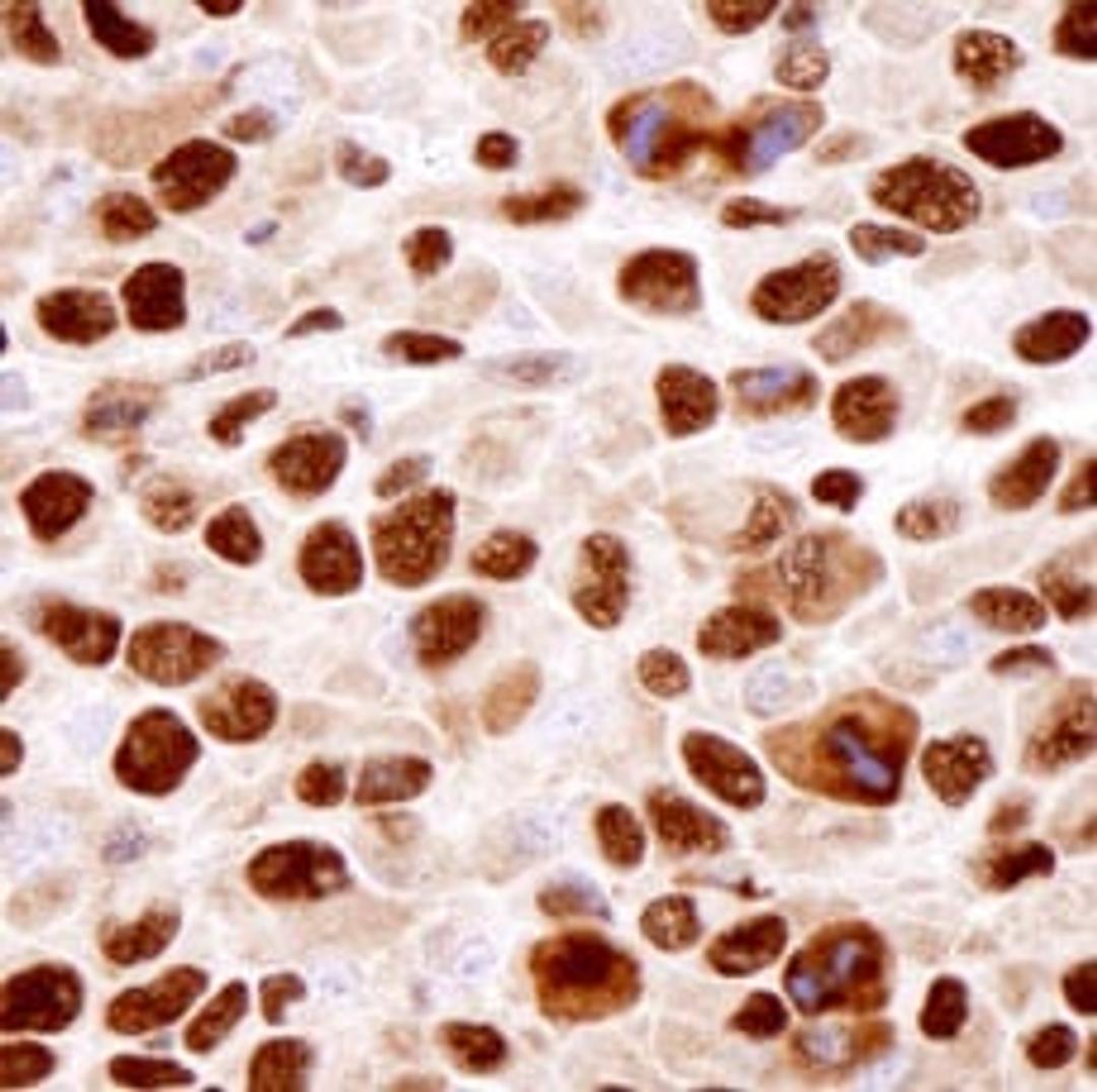 Detection of mouse hnRNP-K by immunohistochemistry.