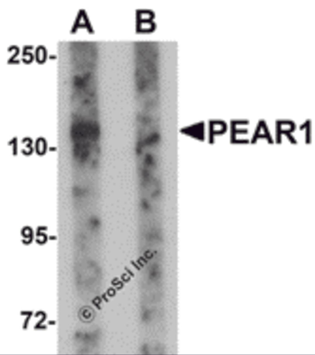 Western blot analysis of PEAR1 in rat kidney tissue lysate with PEAR1 antibody at 1 &#956;g/mL in (A) the absence and (B) the presence of blocking peptide.