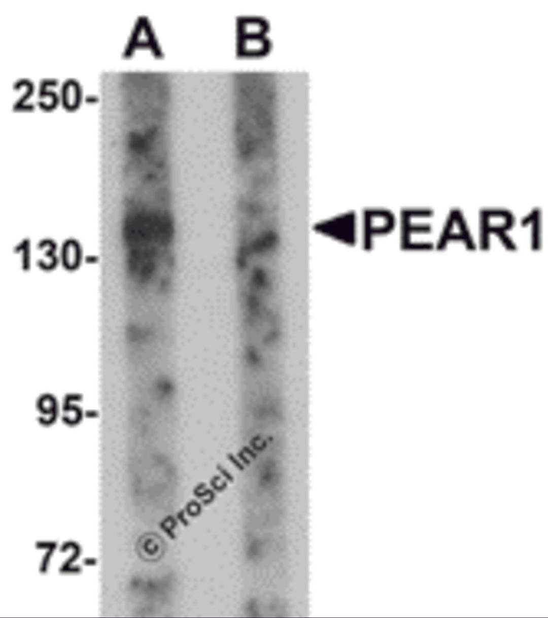 Western blot analysis of PEAR1 in rat kidney tissue lysate with PEAR1 antibody at 1 μg/mL in (A) the absence and (B) the presence of blocking peptide.