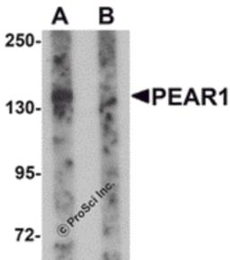 Western blot analysis of PEAR1 in rat kidney tissue lysate with PEAR1 antibody at 1 μg/mL in (A) the absence and (B) the presence of blocking peptide.