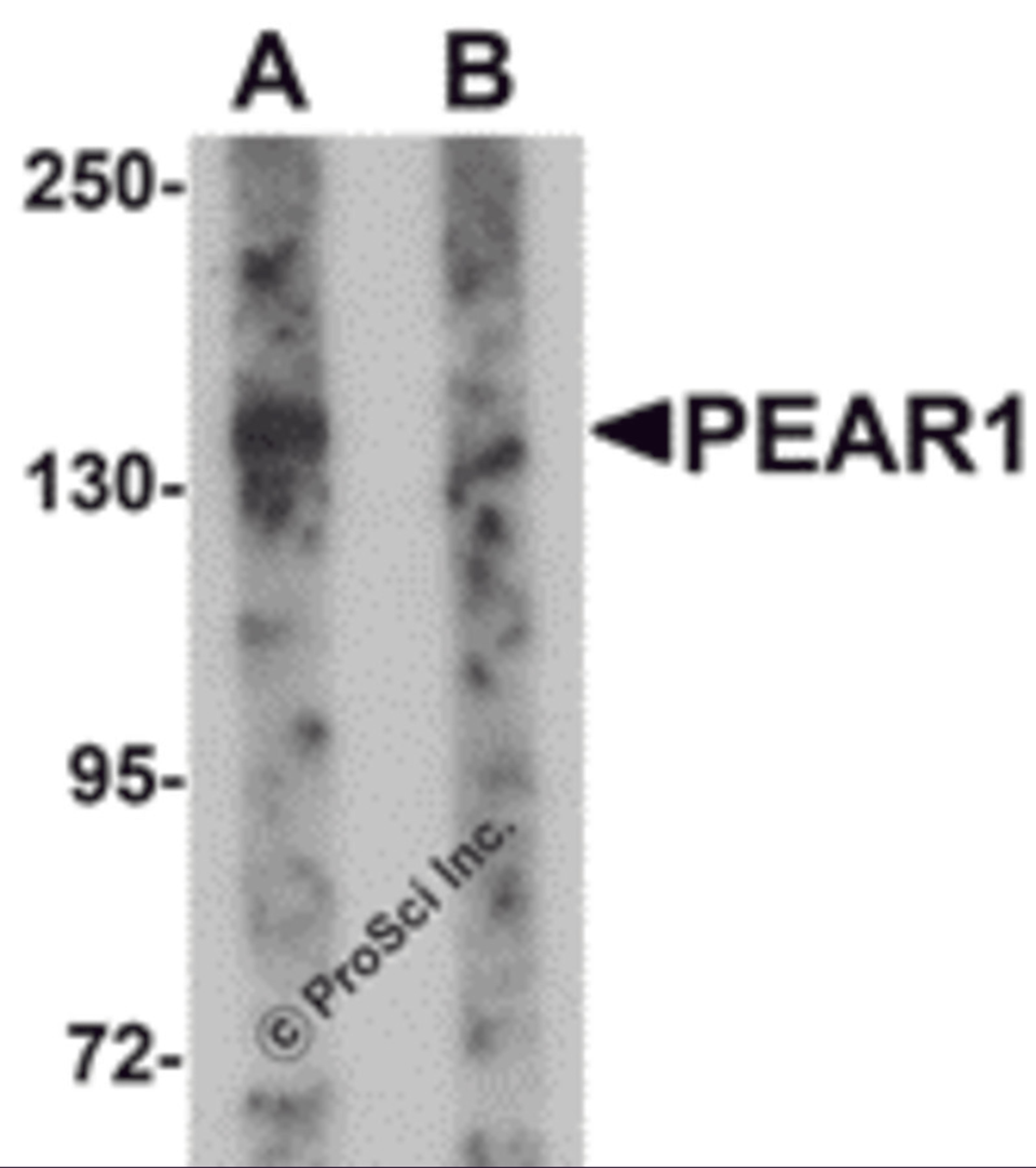 Western blot analysis of PEAR1 in rat kidney tissue lysate with PEAR1 antibody at 1 μg/mL in (A) the absence and (B) the presence of blocking peptide.