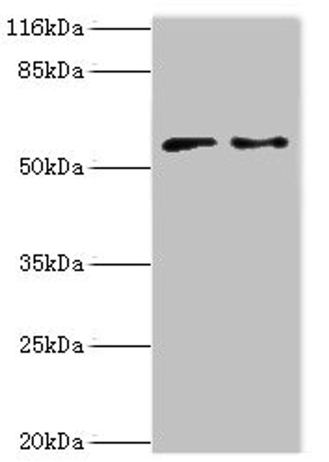 Western blot. All lanes: CRISPLD2 antibody at 2ug/ml. Lane 1: Jurkat whole cell lysate. Lane 2: CEM whole cell lysate. Secondary. Goat polyclonal to rabbit IgG at 1/10000 dilution. Predicted band size: 56, 52, 43, 18, 14 kDa. Observed band size: 56 kDa.