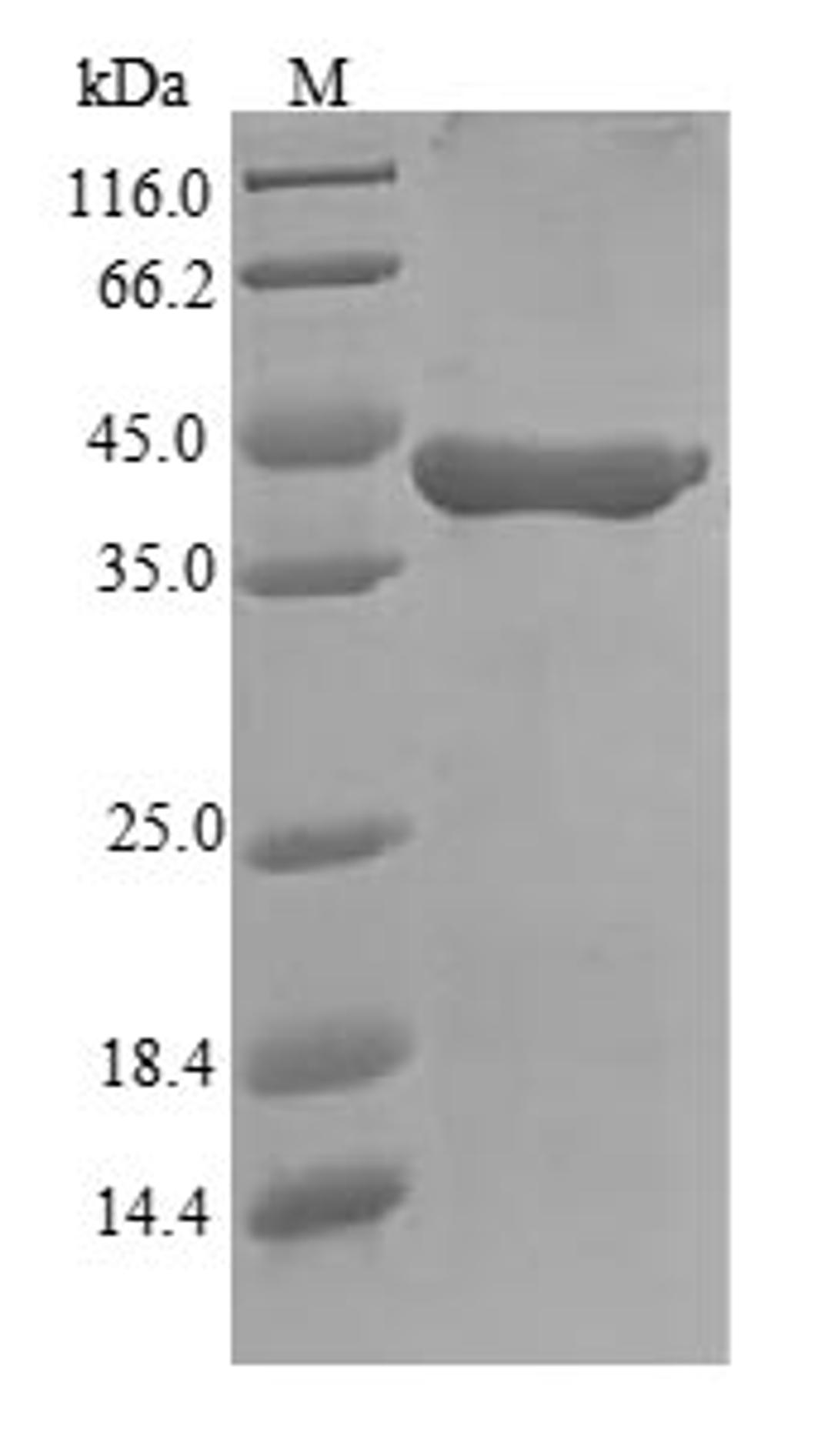 (Tris-Glycine gel) Discontinuous SDS-PAGE (reduced) with 5% enrichment gel and 15% separation gel.