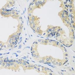 Immunohistochemical staining of rat kidney tissue using UPF2 antibody