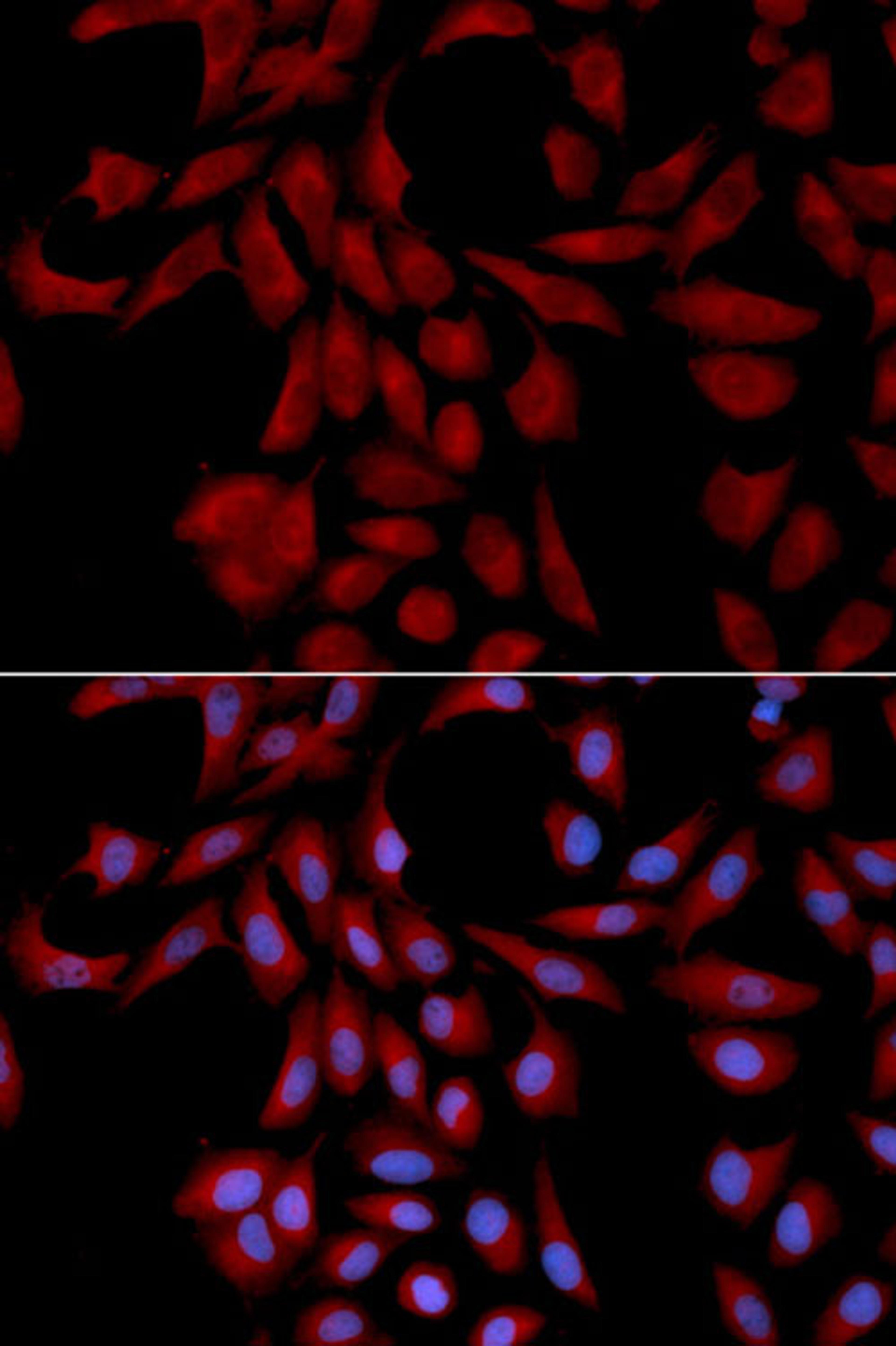 Immunofluorescence - UBE2I antibody (A13558)