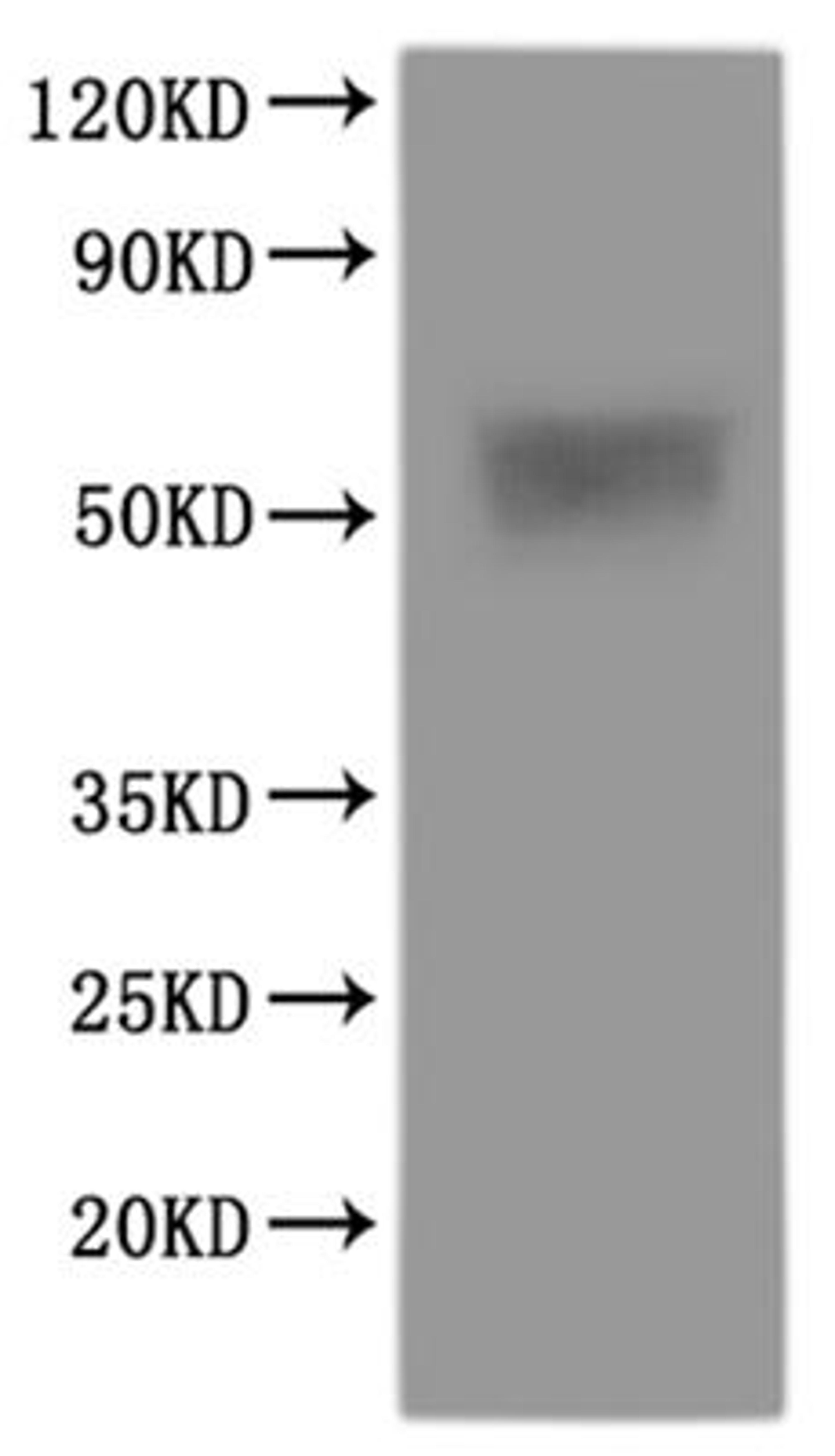 CSB-MP4165HU is detected by Mouse anti-6*His monoclonal antibody.