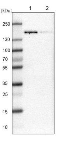 Western Blot: TATA Element Modulatory Factor 1 Antibody [NBP1-90117] - Lane 1: NIH-3T3 cell lysate (Mouse embryonic fibroblast cells)<br/>Lane 2: NBT-II cell lysate (Rat Wistar bladder tumour cells)