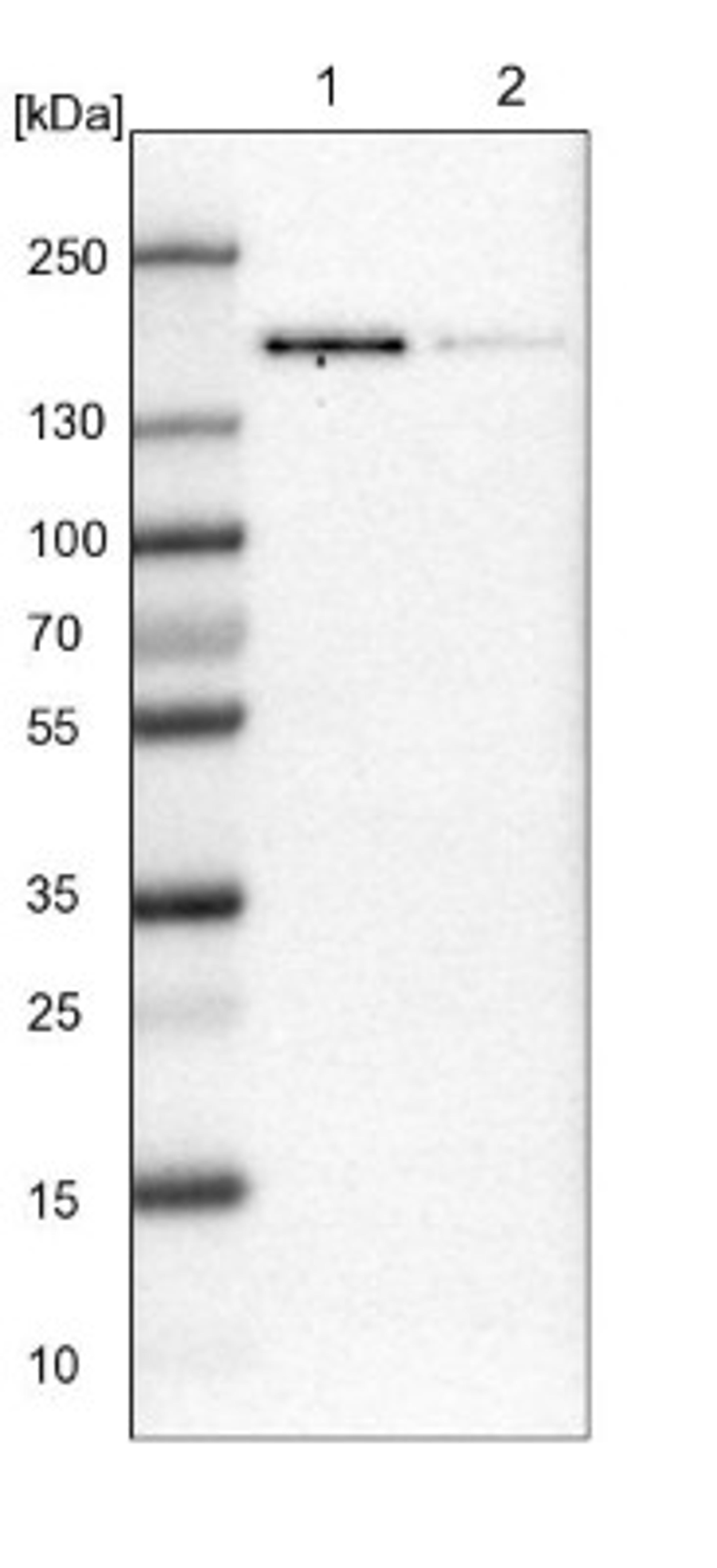 Western Blot: TATA Element Modulatory Factor 1 Antibody [NBP1-90117] - Lane 1: NIH-3T3 cell lysate (Mouse embryonic fibroblast cells)<br/>Lane 2: NBT-II cell lysate (Rat Wistar bladder tumour cells)