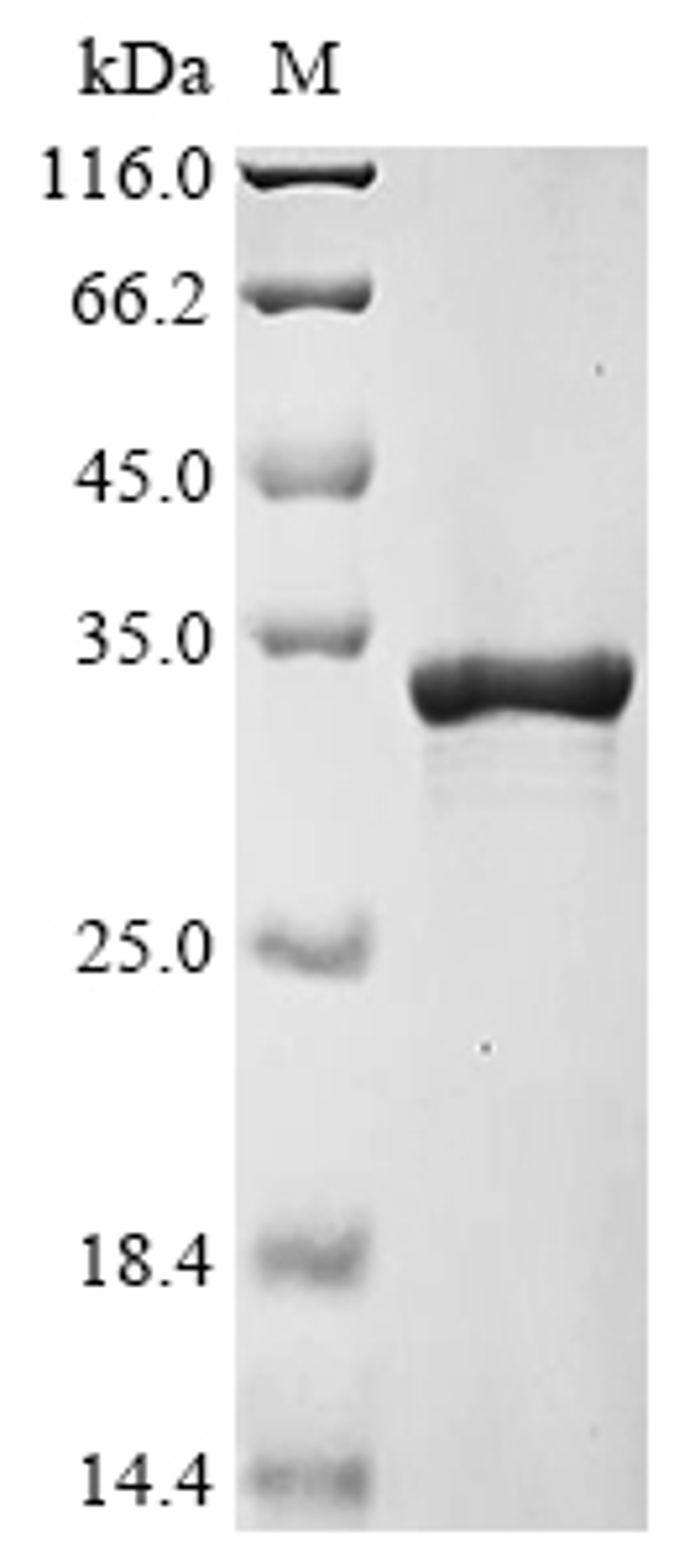 (Tris-Glycine gel) Discontinuous SDS-PAGE (reduced) with 5% enrichment gel and 15% separation gel.