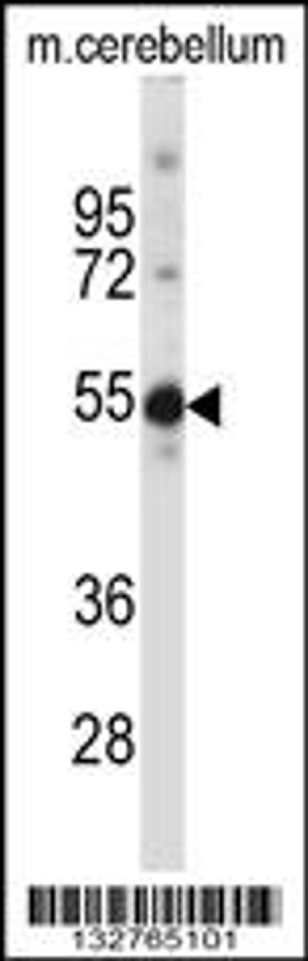 Western blot analysis in mouse cerebellum tissue lysates (35ug/lane).