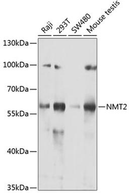 Western blot - NMT2 antibody (A7042)