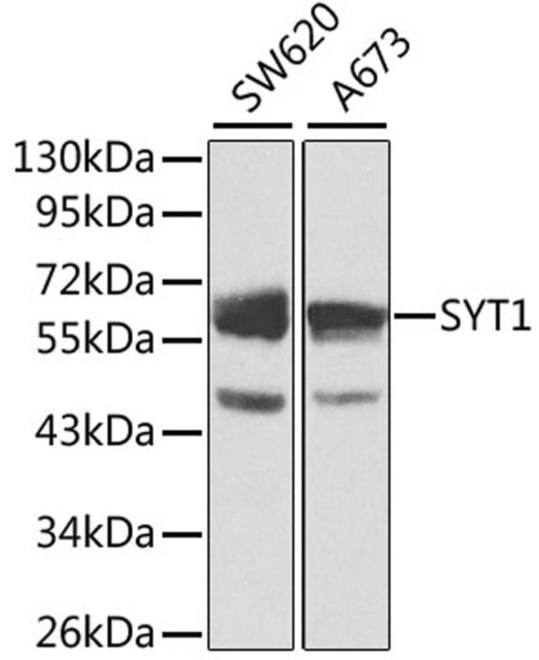 Western blot - SYT1 antibody (A0992)