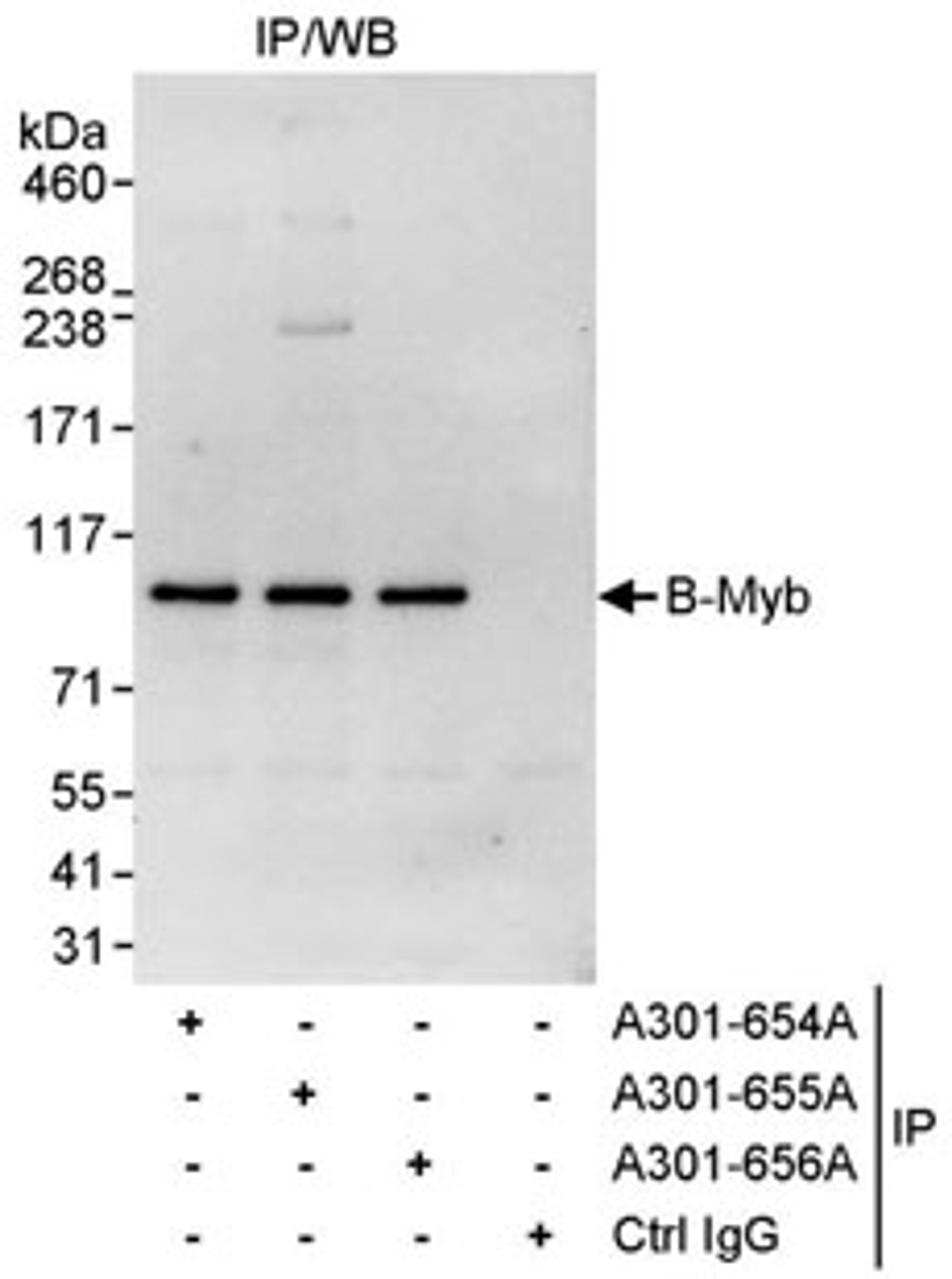 Detection of human B-Myb by western blot of immunoprecipitates.