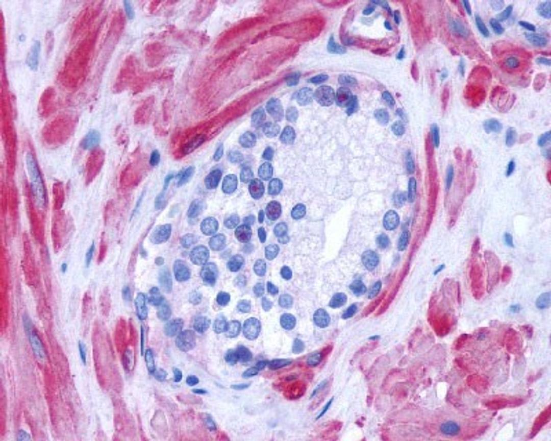 Immunohistochemistry-Paraffin: alpha-1D Adrenergic R/ADRA1D Antibody [NLS12] - Analysis of anti-ADRA1D antibody with human prostate.