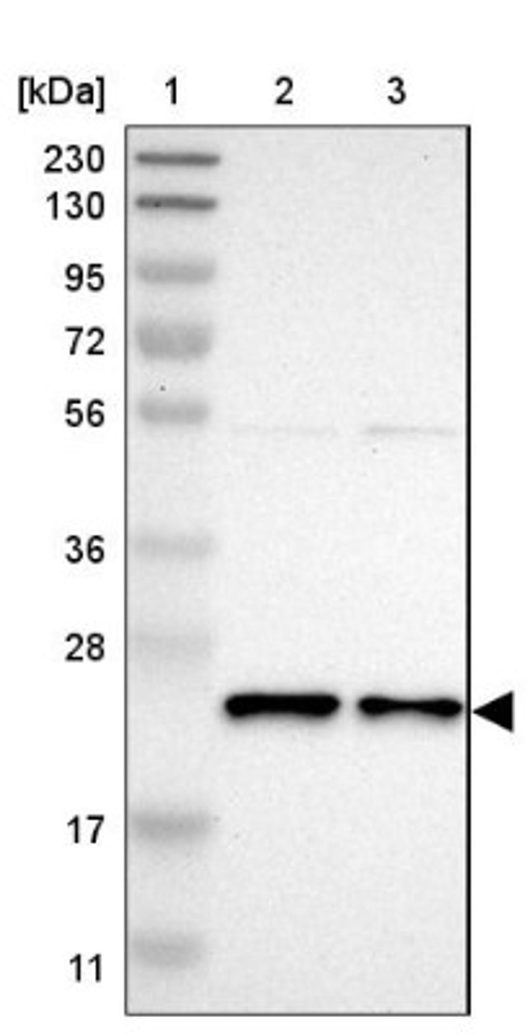 Western Blot: YIF1A Antibody [NBP1-89362] - Lane 1: Marker [kDa] 230, 130, 95, 72, 56, 36, 28, 17, 11<br/>Lane 2: Human cell line RT-4<br/>Lane 3: Human cell line U-251MG sp