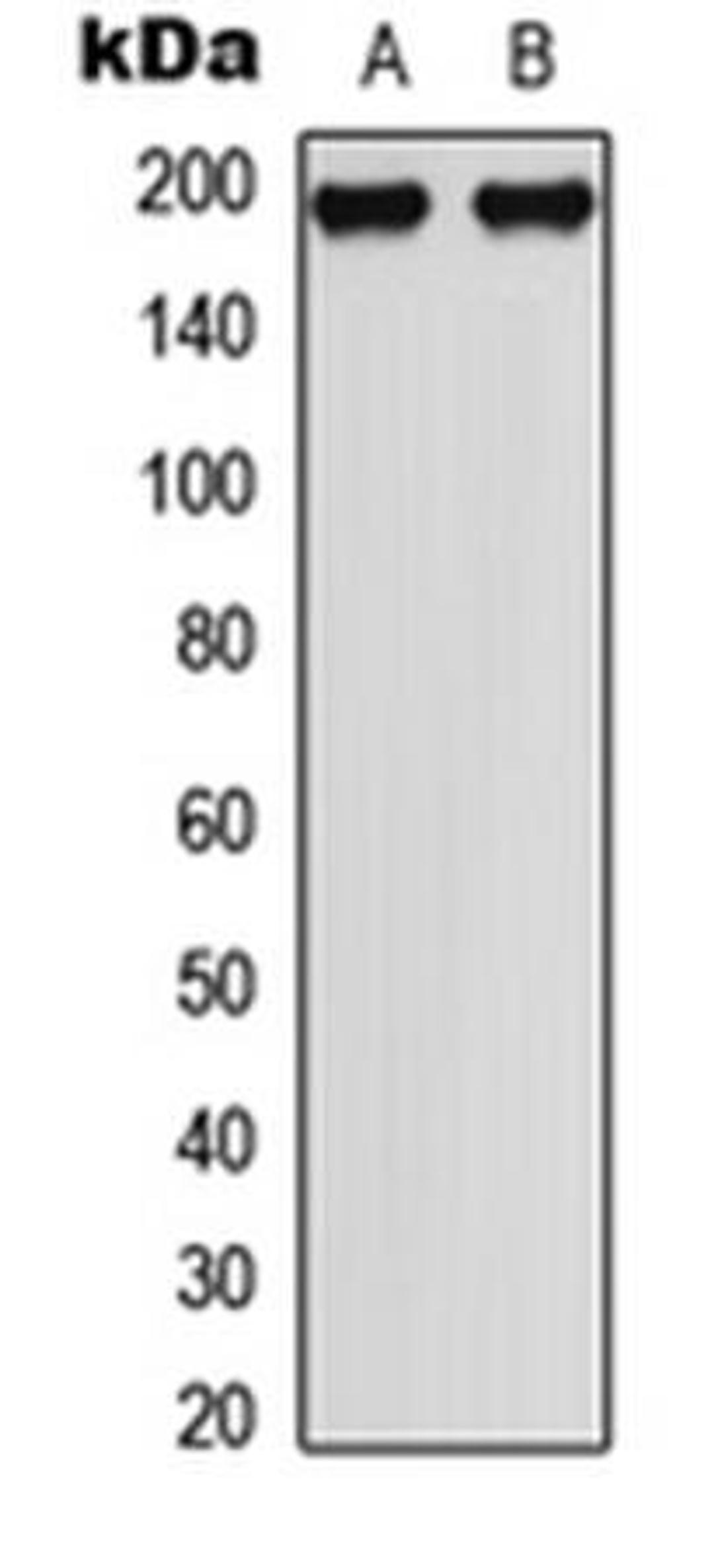 Western blot analysis of HeLa (Lane1), NIH3T3 (Lane2) whole cell using MEKK1 (phospho-T1402) antibody