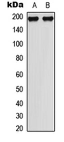 Western blot analysis of HeLa (Lane1), NIH3T3 (Lane2) whole cell using MEKK1 (phospho-T1402) antibody