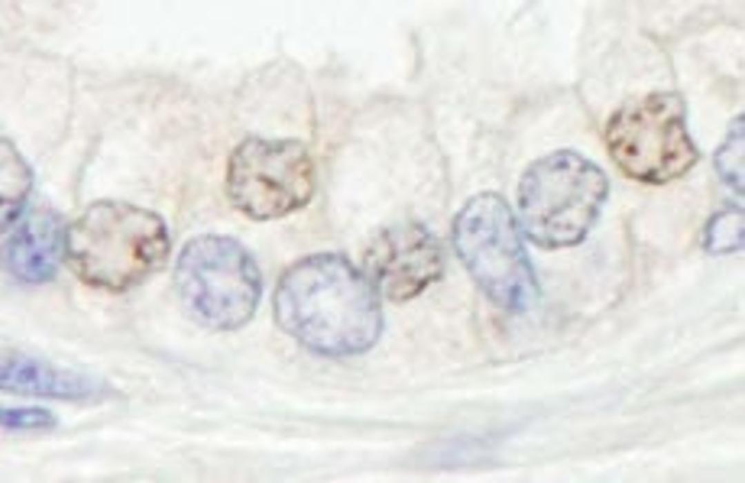 Detection of human XPF/ERCC4 by immunohistochemistry.