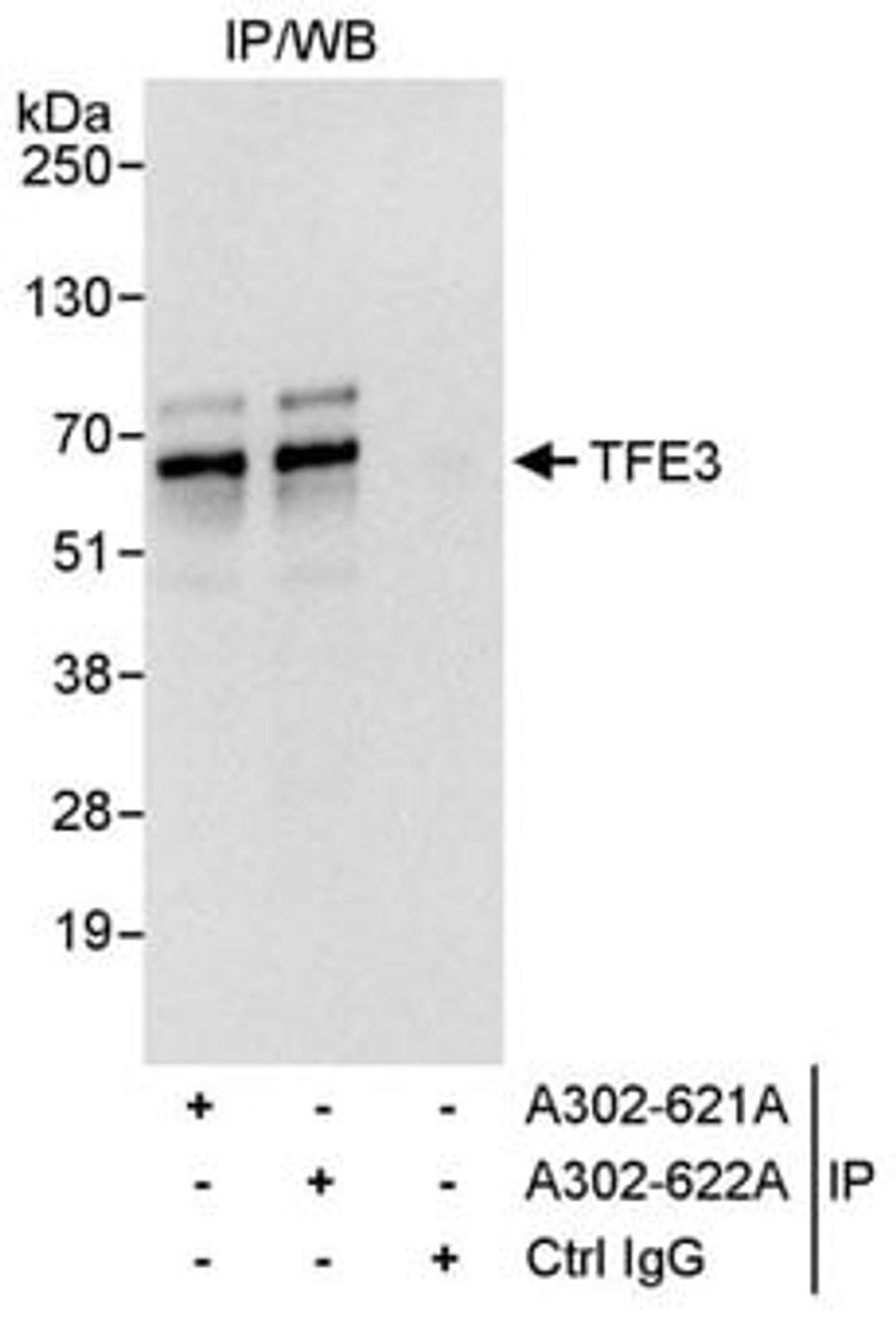 Detection of human TFE3 by western blot of immunoprecipitates.