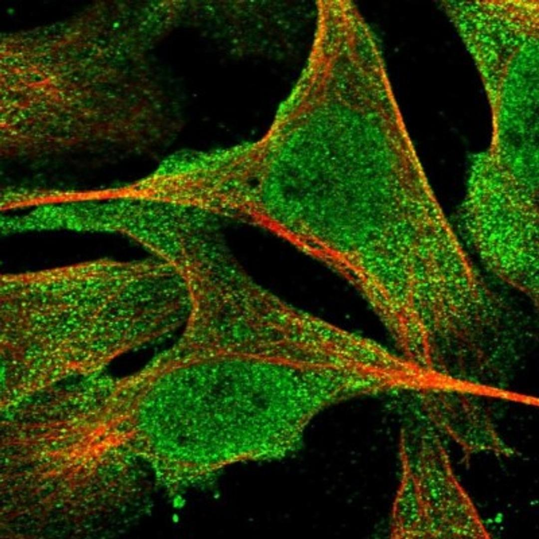 Immunocytochemistry/Immunofluorescence: FLJ10815 Antibody [NBP1-87910] - Staining of human cell line U-2 OS shows positivity in nucleus but not nucleoli, plasma membrane & cytoplasm.