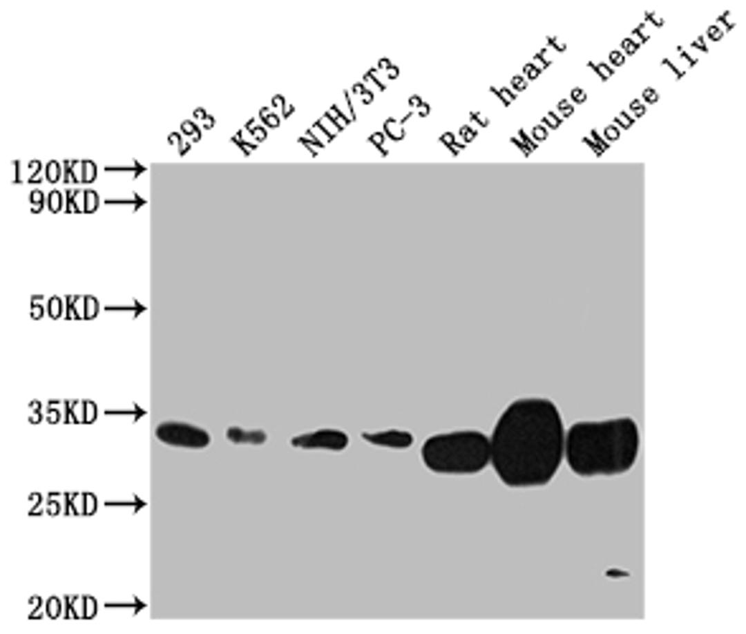 Western Blot. Positive WB detected in: 293 whole cell lysate, K562 whole cell lysate, NIH/3T3 whole cell lysate, PC-3 whole cell lysate, Rat heart tissue, Mouse heart tissue, Mouse liver tissue. All lanes: SDHB antibody at 1:2000. Secondary. Goat polyclonal to rabbit IgG at 1/50000 dilution. Predicted band size: 32 kDa. Observed band size: 32 kDa.