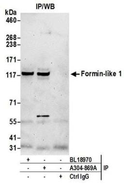 Detection of human Formin-like 1 by western blot of immunoprecipitates.