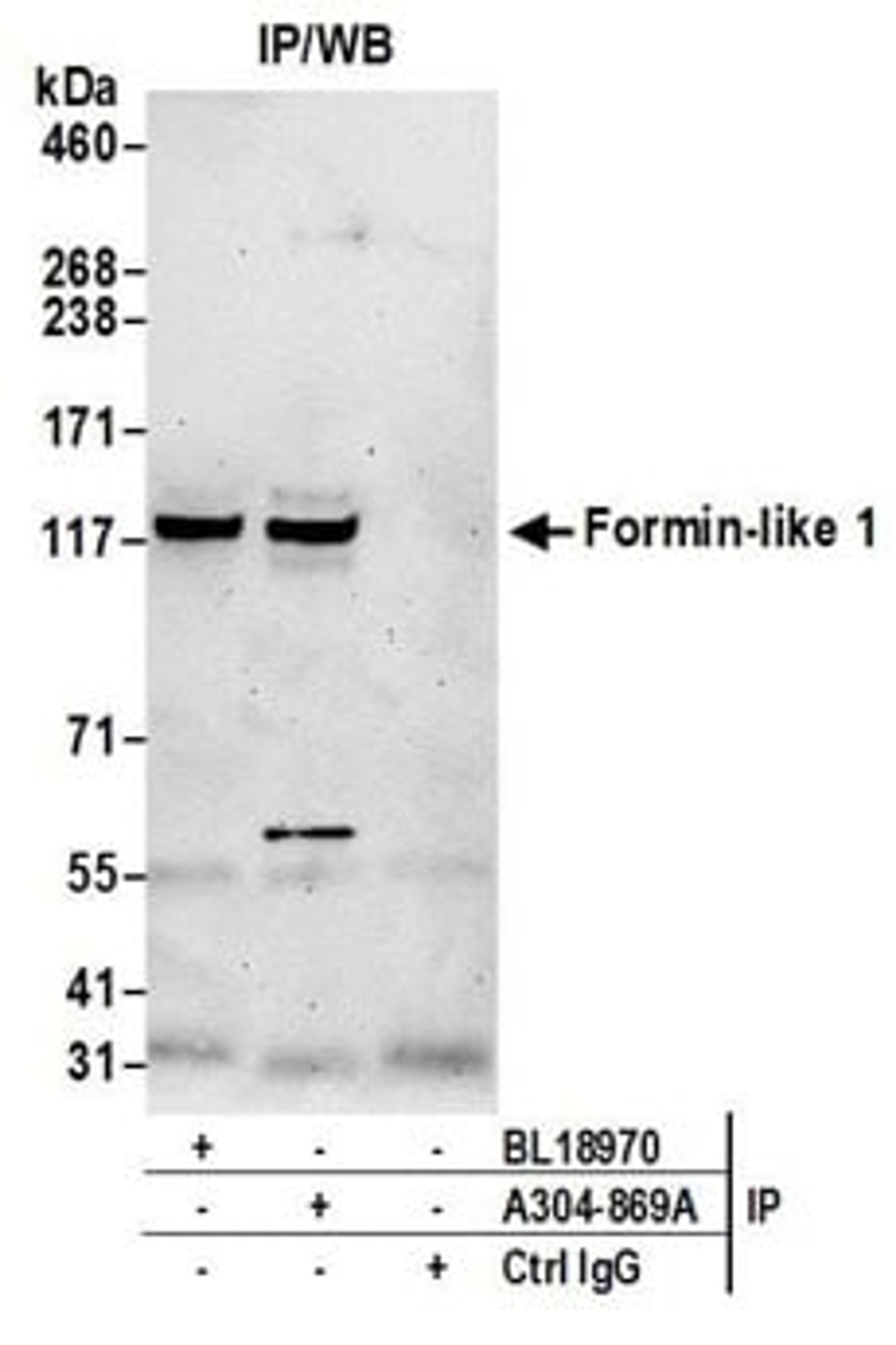 Detection of human Formin-like 1 by western blot of immunoprecipitates.