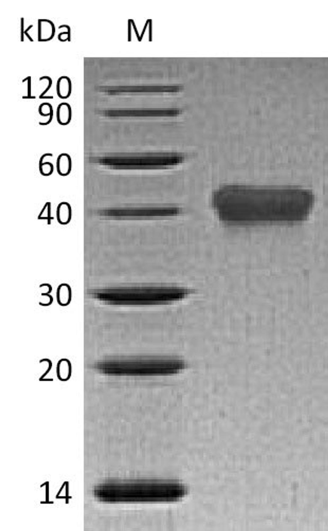 (Tris-Glycine gel) Discontinuous SDS-PAGE (reduced) with 5% enrichment gel and 15% separation gel.