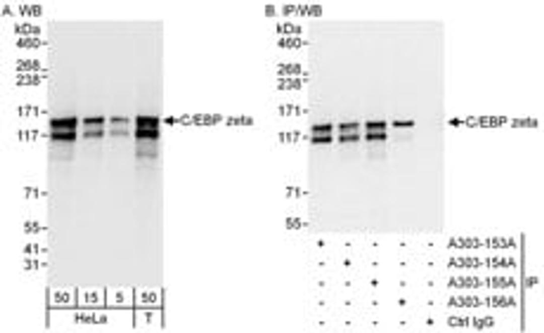 Detection of human C/EBP zeta by western blot and immunoprecipitation.