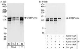 Detection of human C/EBP zeta by western blot and immunoprecipitation.