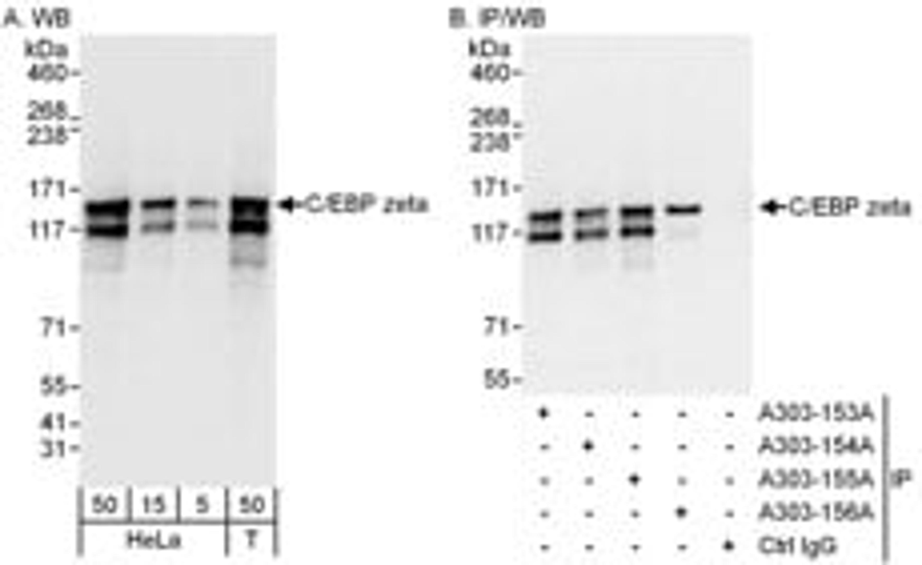 Detection of human C/EBP zeta by western blot and immunoprecipitation.