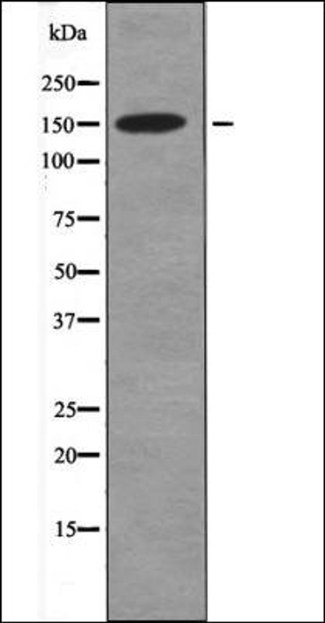 Western blot analysis of K562 whole cell lysates using CD45 -Phospho-Tyr1216- antibody