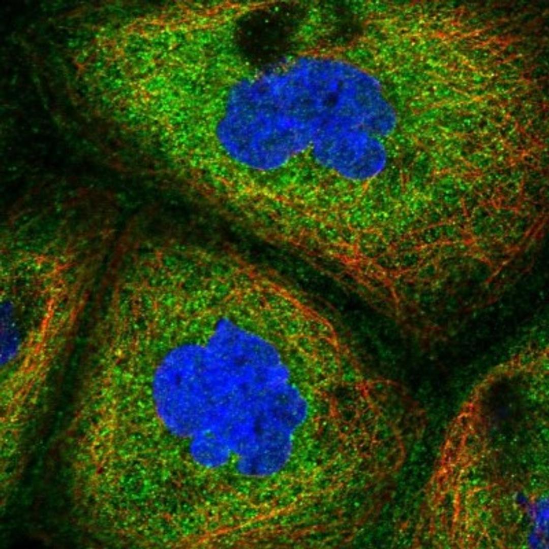 Immunocytochemistry/Immunofluorescence: NARFL Antibody [NBP1-83611] - Staining of human cell line A-431 shows positivity in cytoplasm.