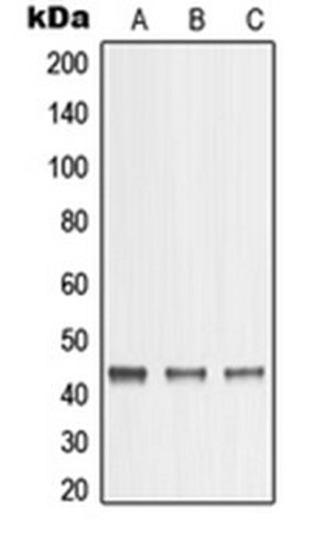 Western blot analysis of A431 (Lane 1), A375 (Lane 2), HeLa (Lane 3) whole cell lysates using MMP23A antibody