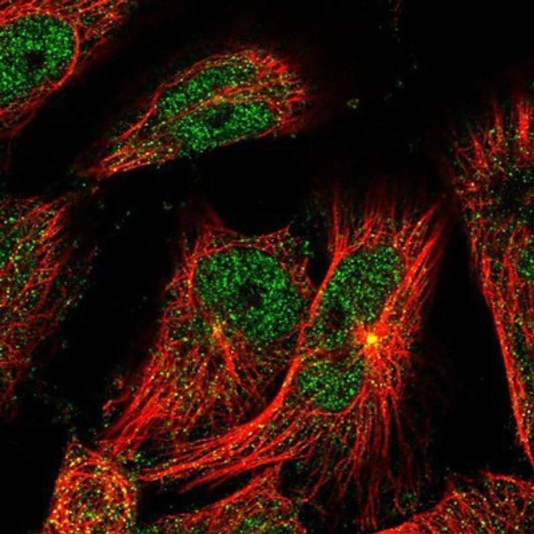 Immunocytochemistry/Immunofluorescence: TSEN2 Antibody [NBP1-81141] - Staining of human cell line U-251 MG shows positivity in nucleus but not nucleoli, cytoplasm & centrosome.