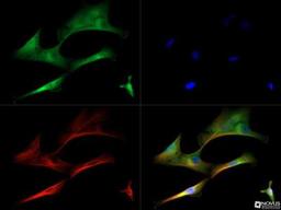 Immunocytochemistry/Immunofluorescence: MMP-13 Antibody [NBP1-45723] - MMP-13 antibody was tested at 1:50 in MDA-MB-231 cells with Dylight 488 (green). Nuclei and alpha-tubulin were counterstained with DAPI (blue) and Dylight 550 (red). Image objective 40x.