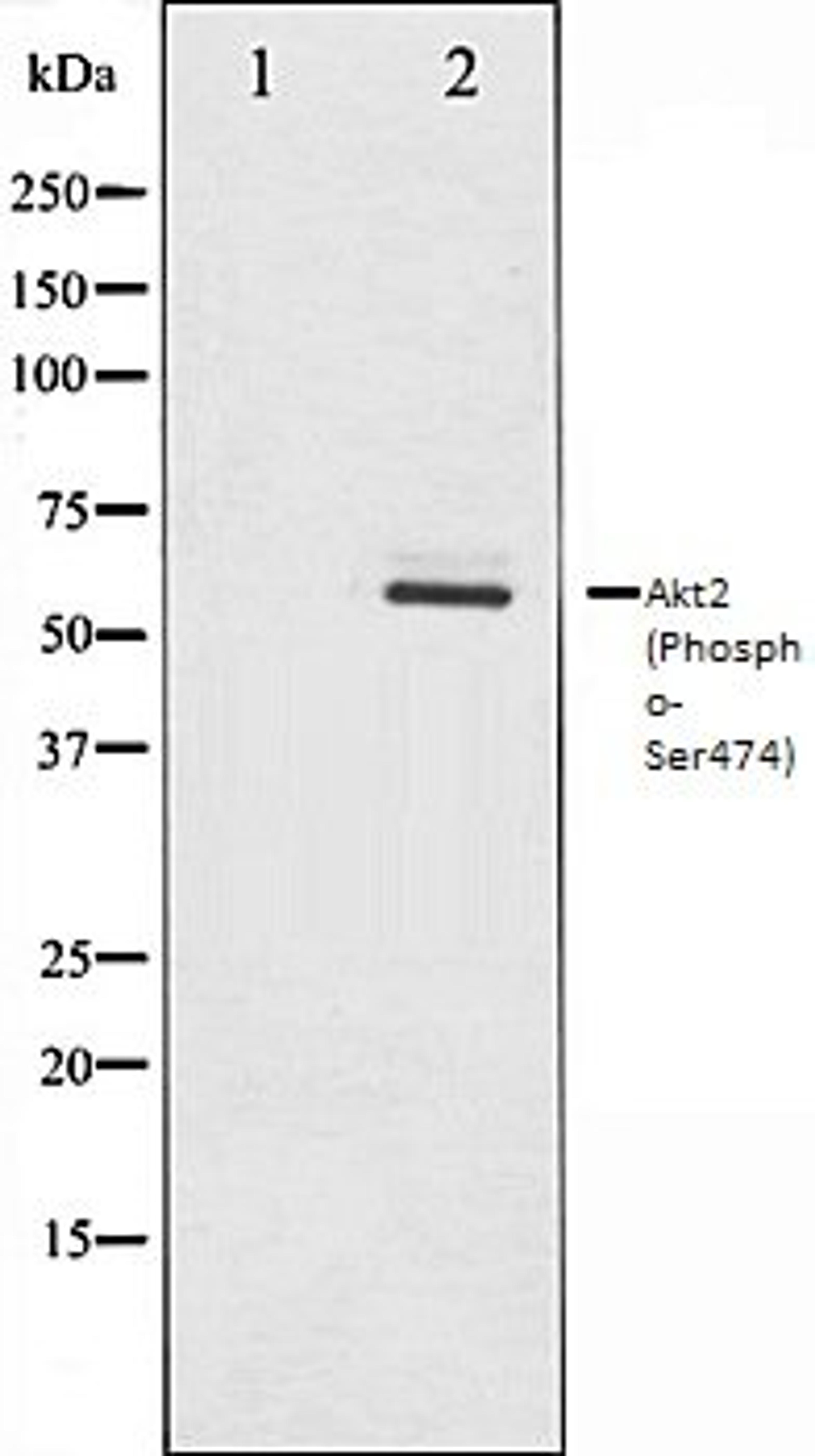 Western blot analysis of A2780 whole cell lysates using Akt2 (Phospho-Ser474) antibody, The lane on the left is treated with the antigen-specific peptide.