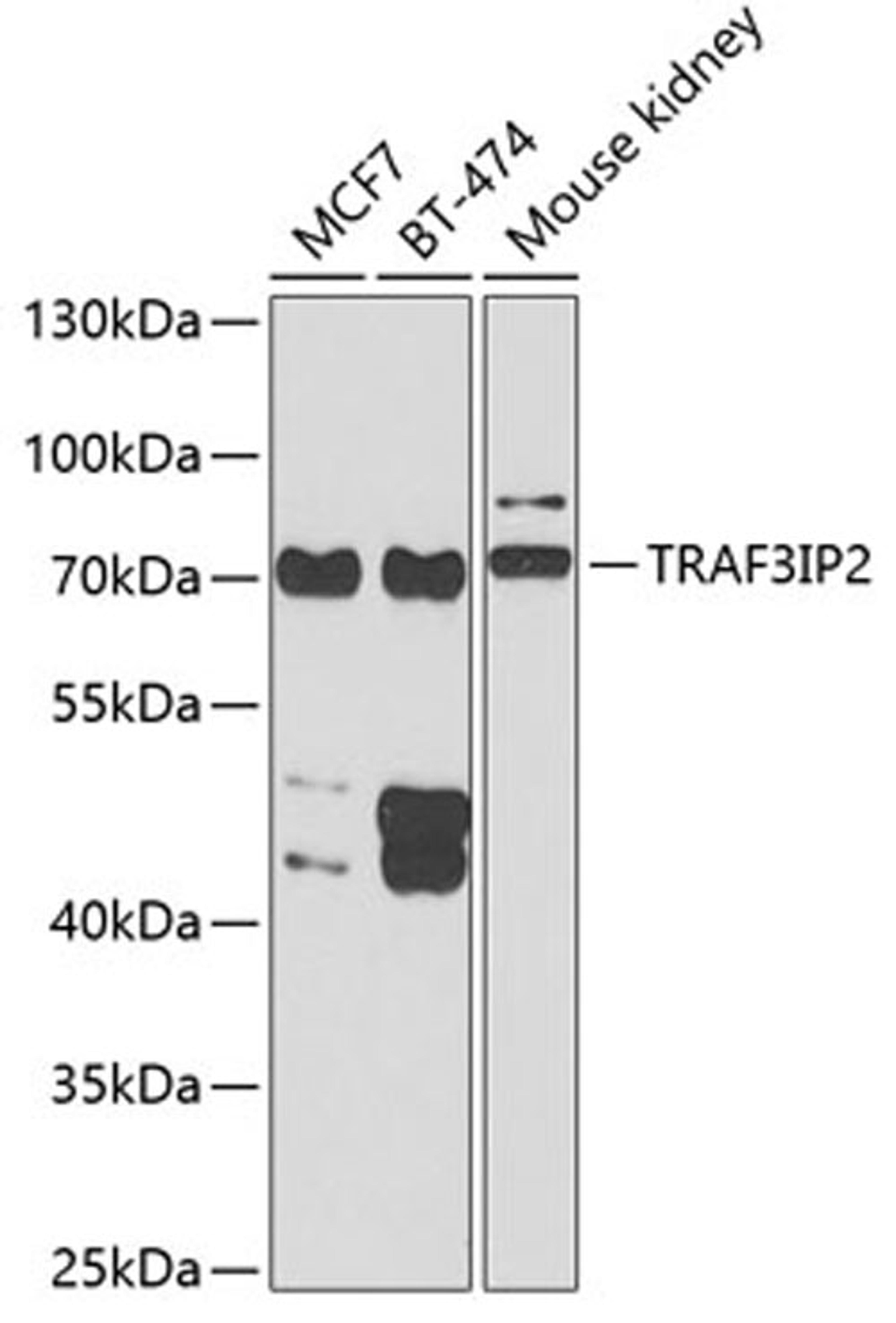 Western blot - TRAF3IP2 antibody (A6776)