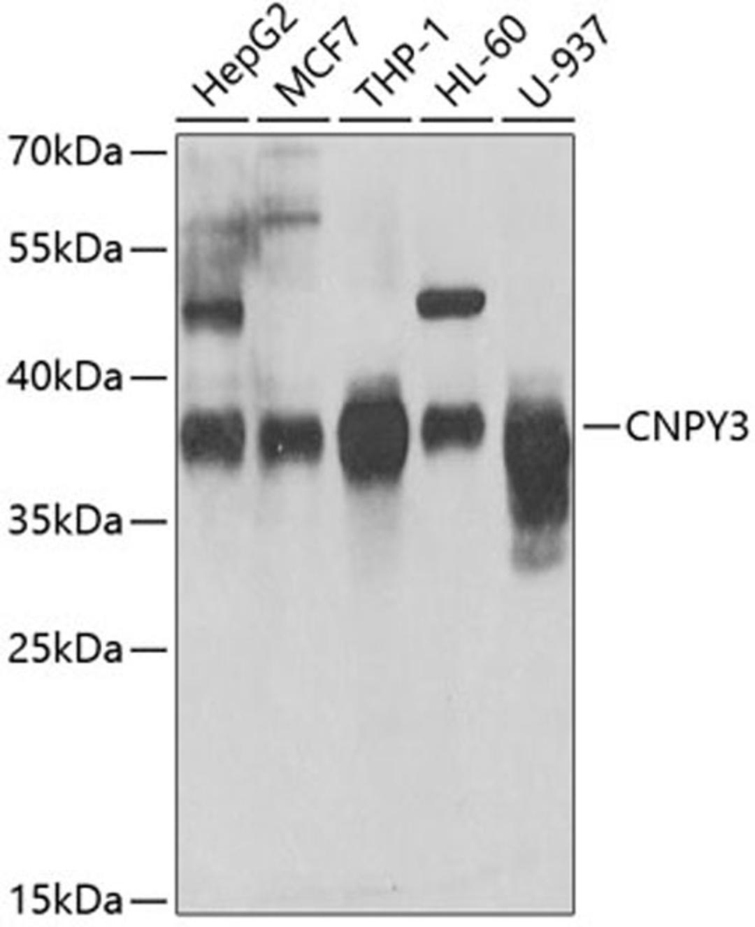 Western blot - CNPY3 antibody (A7176)