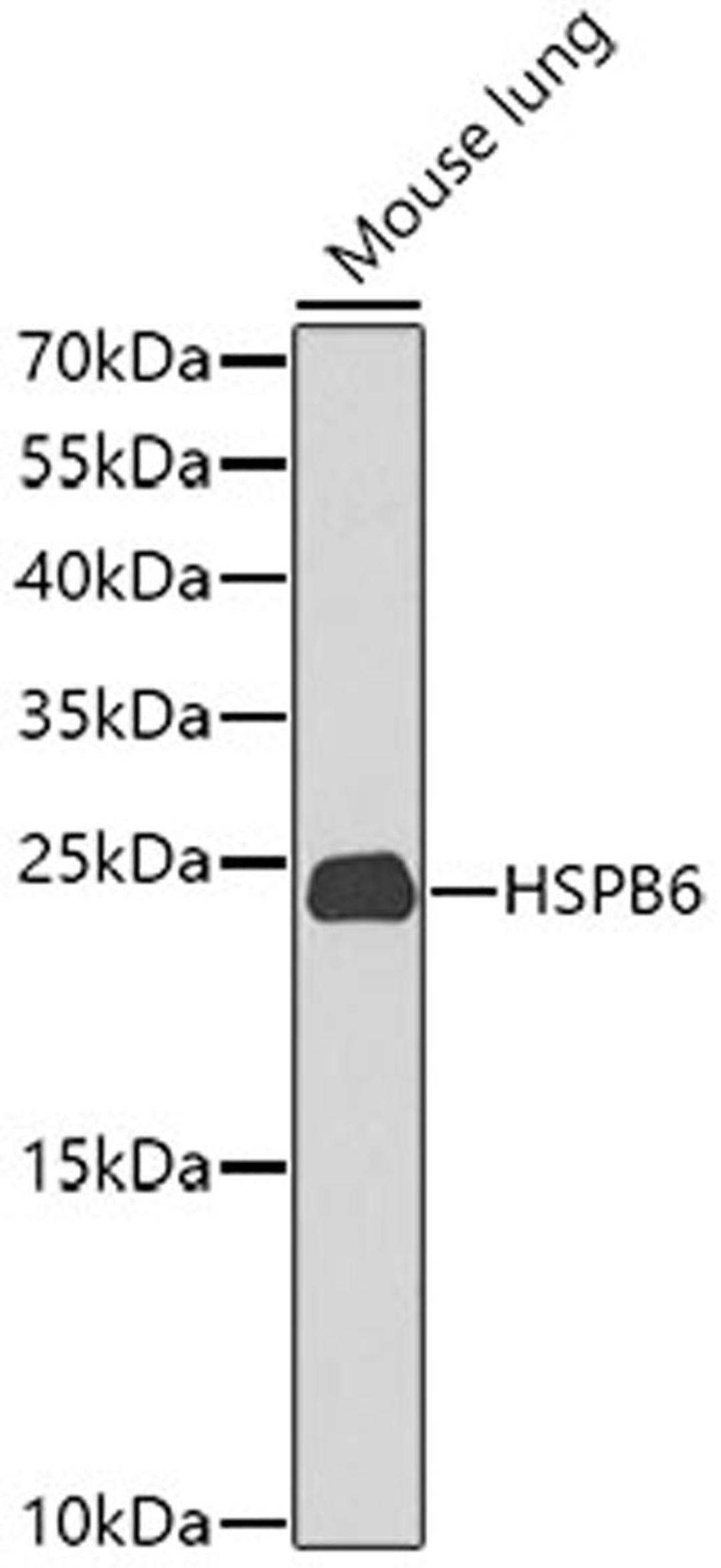 Western blot - HSPB6 antibody (A9887)