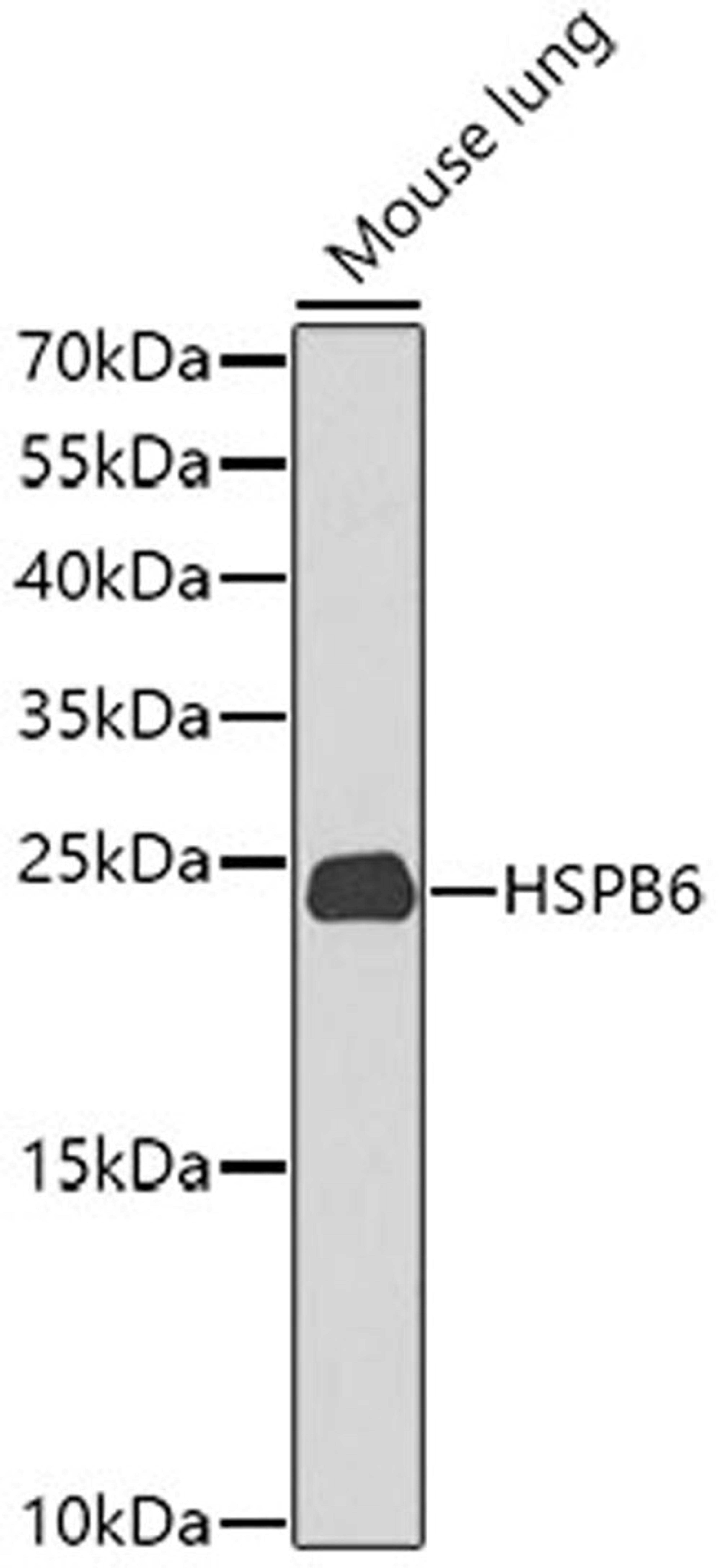 Western blot - HSPB6 antibody (A9887)