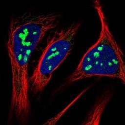 Immunocytochemistry/Immunofluorescence: RRP15 Antibody [NBP1-84522] - Staining of human cell line U-2 OS shows positivity in nucleoli & mitochondria.