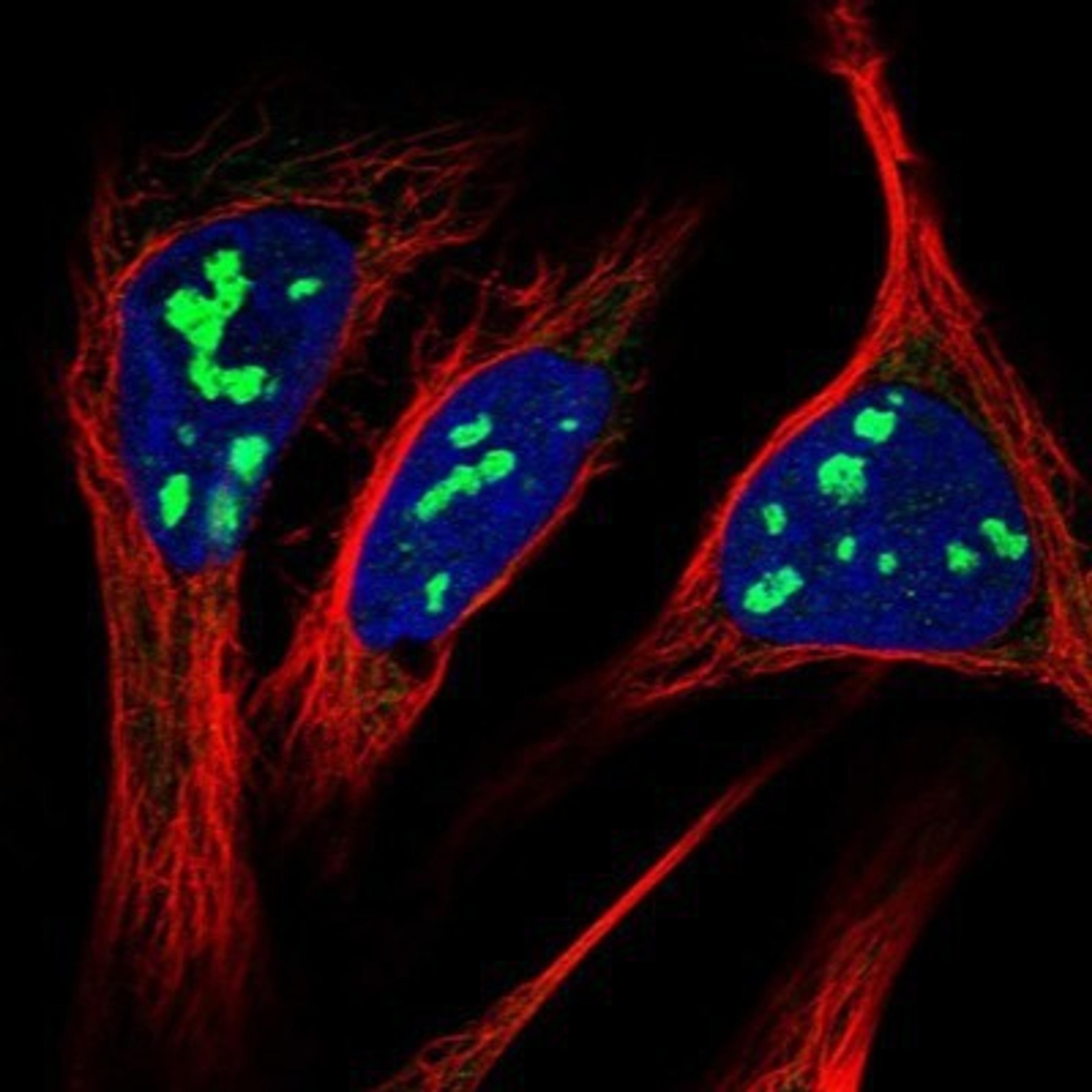 Immunocytochemistry/Immunofluorescence: RRP15 Antibody [NBP1-84522] - Staining of human cell line U-2 OS shows positivity in nucleoli & mitochondria.