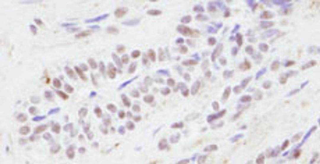 Detection of human CBP by immunohistochemistry.