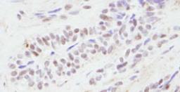 Detection of human CBP by immunohistochemistry.