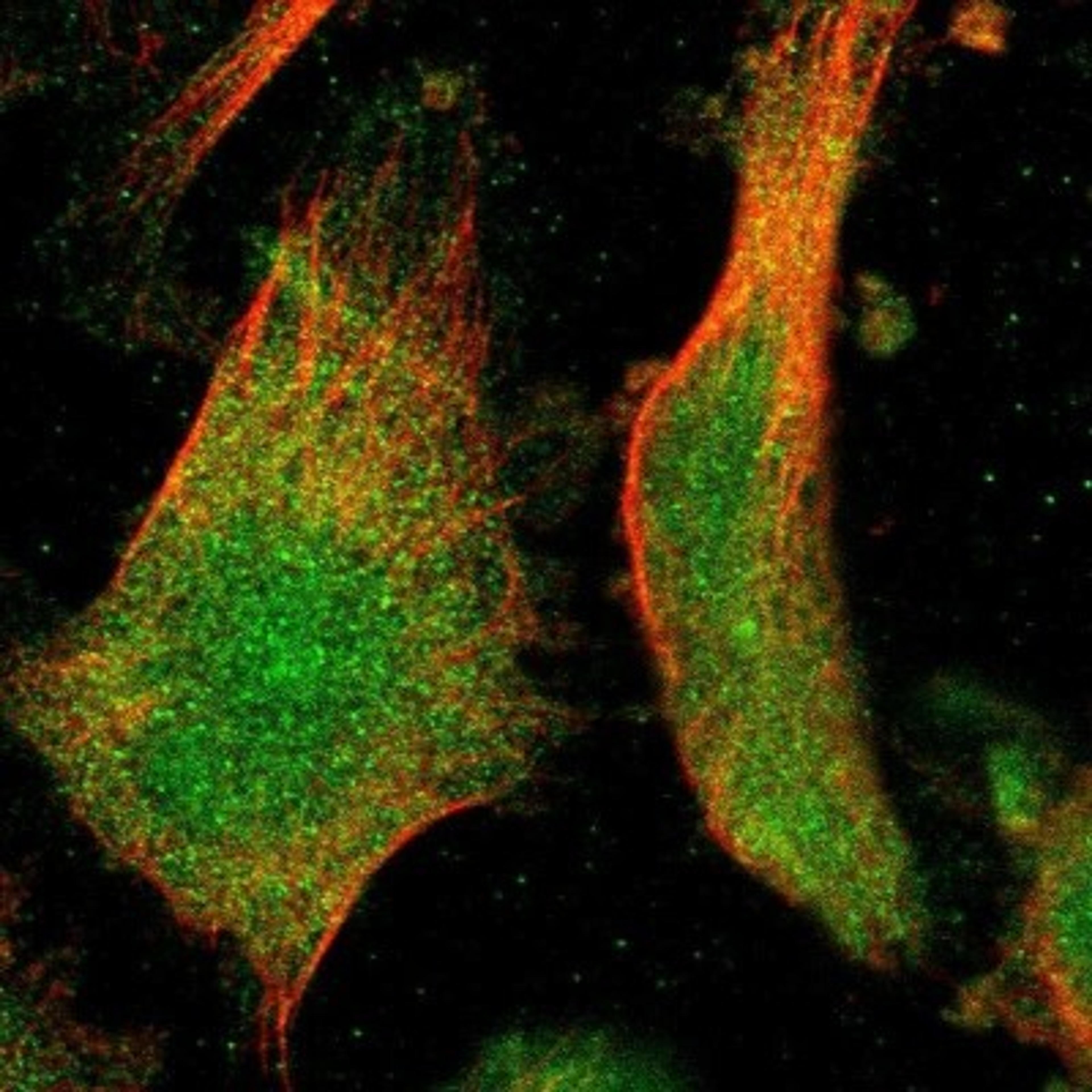 Immunocytochemistry/Immunofluorescence: IFFO2 Antibody [NBP1-91092] - Immunofluorescent staining of human cell line U-251MG shows positivity in nucleus & cytoplasm.