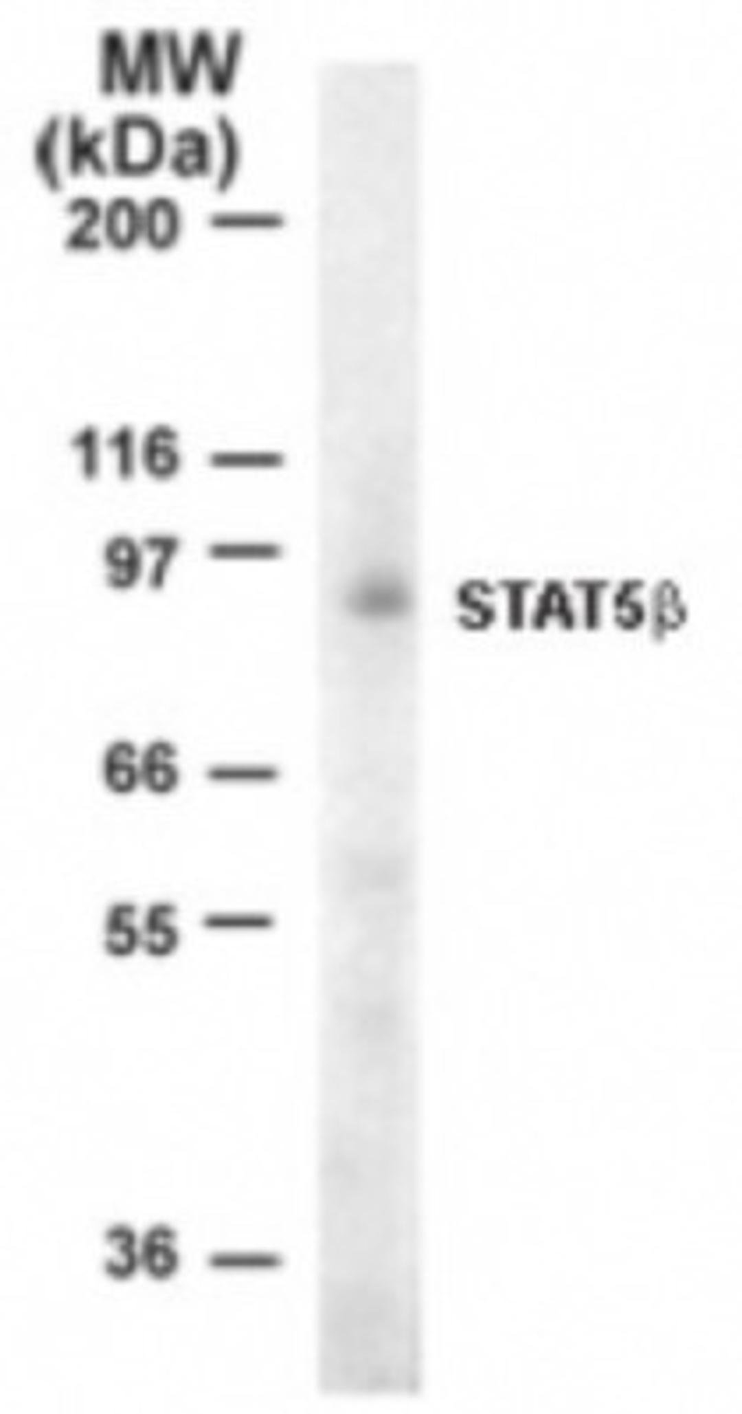 Western Blot: STAT5B Antibody [NB100-56324] - Analysis of Stat5b in 10 ug of Jurkat cell lysate using 1 ug/ml this antibody. Immunoreaction was detected by chemiluminescence